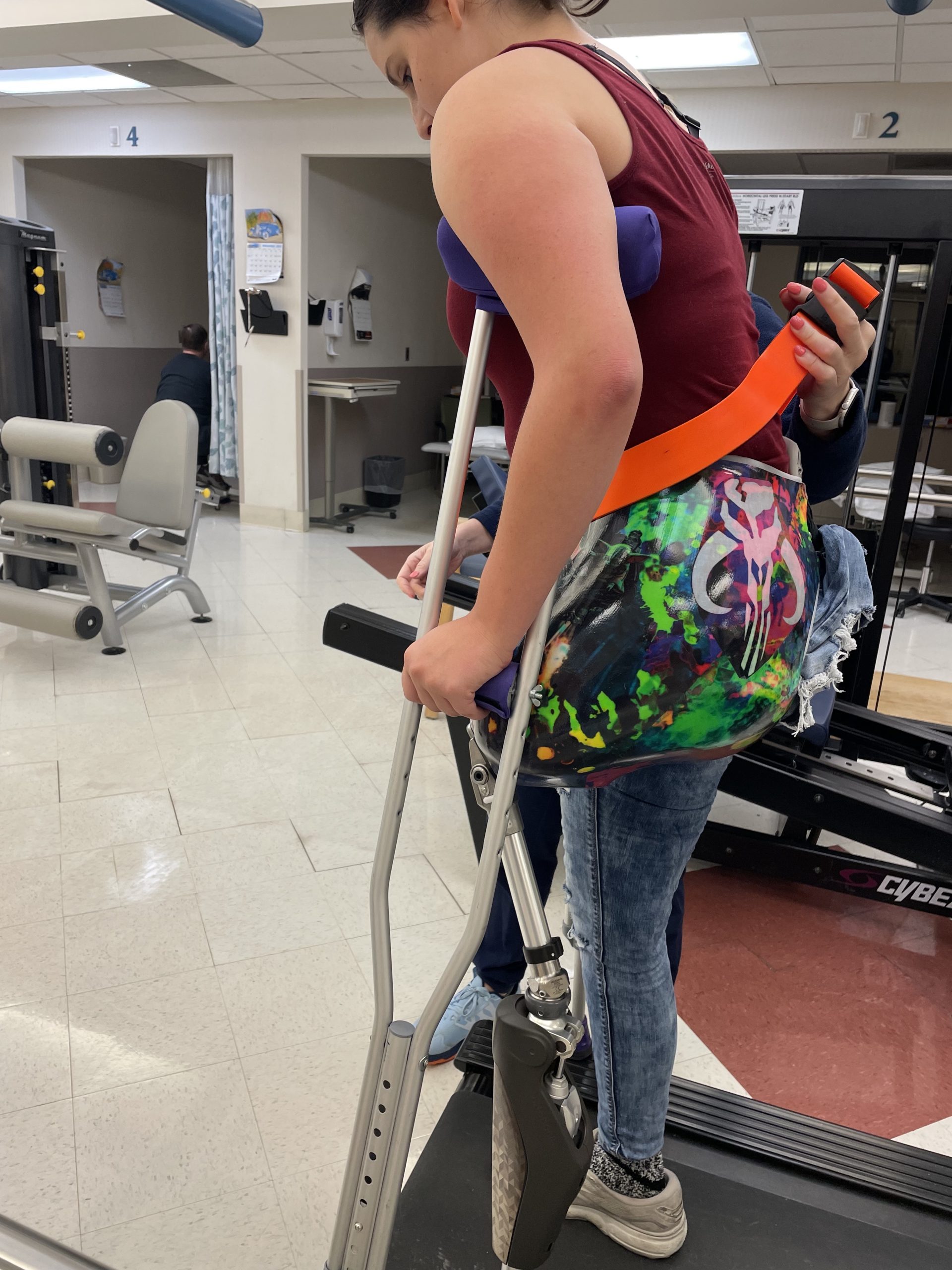My daughter preparing to take a step in her new prosthetic. She has under arm crutches and there is a bright orange gait belt around her waist.